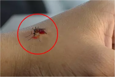 best hospital for malaria treatment in madhepura, best doctor for malaria treatment in madhepura, cost of malaria treatment in shahjahanpu